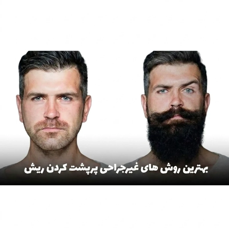 روغن ریش و سیبیل پرپشت شدن موی صورت اصلی Agiva